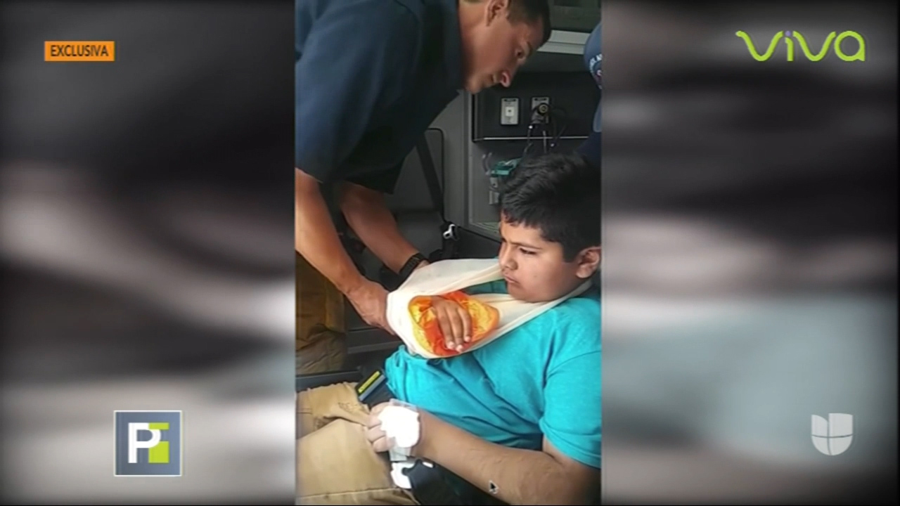 Niño Fue Agredido Por Compañeros De Escuela Hasta Causarle La Fractura De Un Brazo