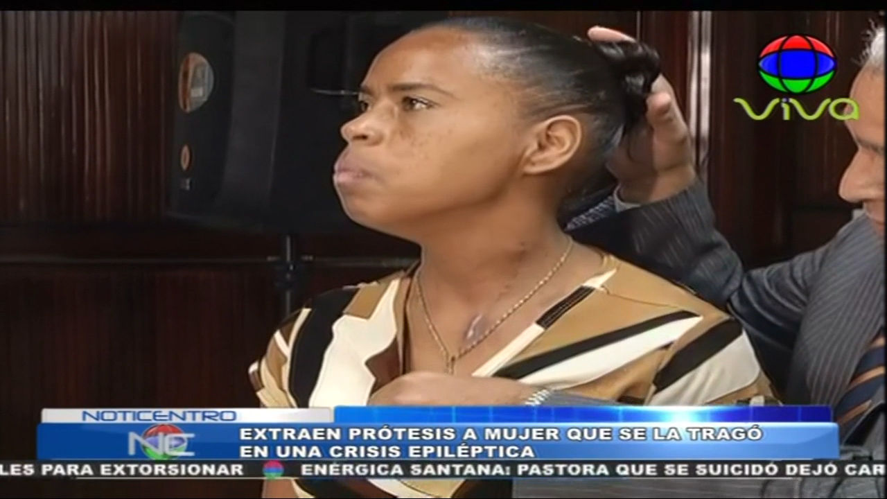 Extraen Prótesis A Mujer Que Se La Tragó En Una Crisis Epiléptica