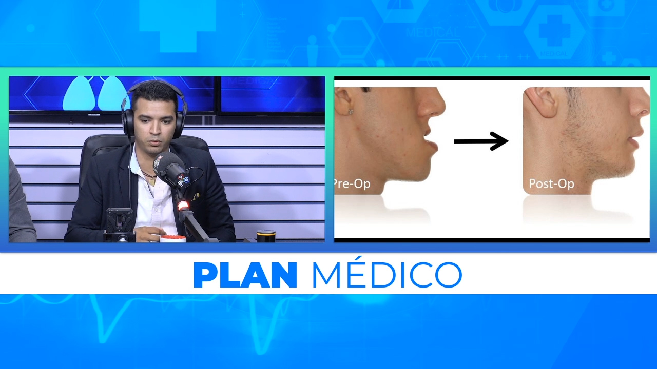 ¿Cómo Se Realiza Una Cirugía Ortognática? | Plan Médico