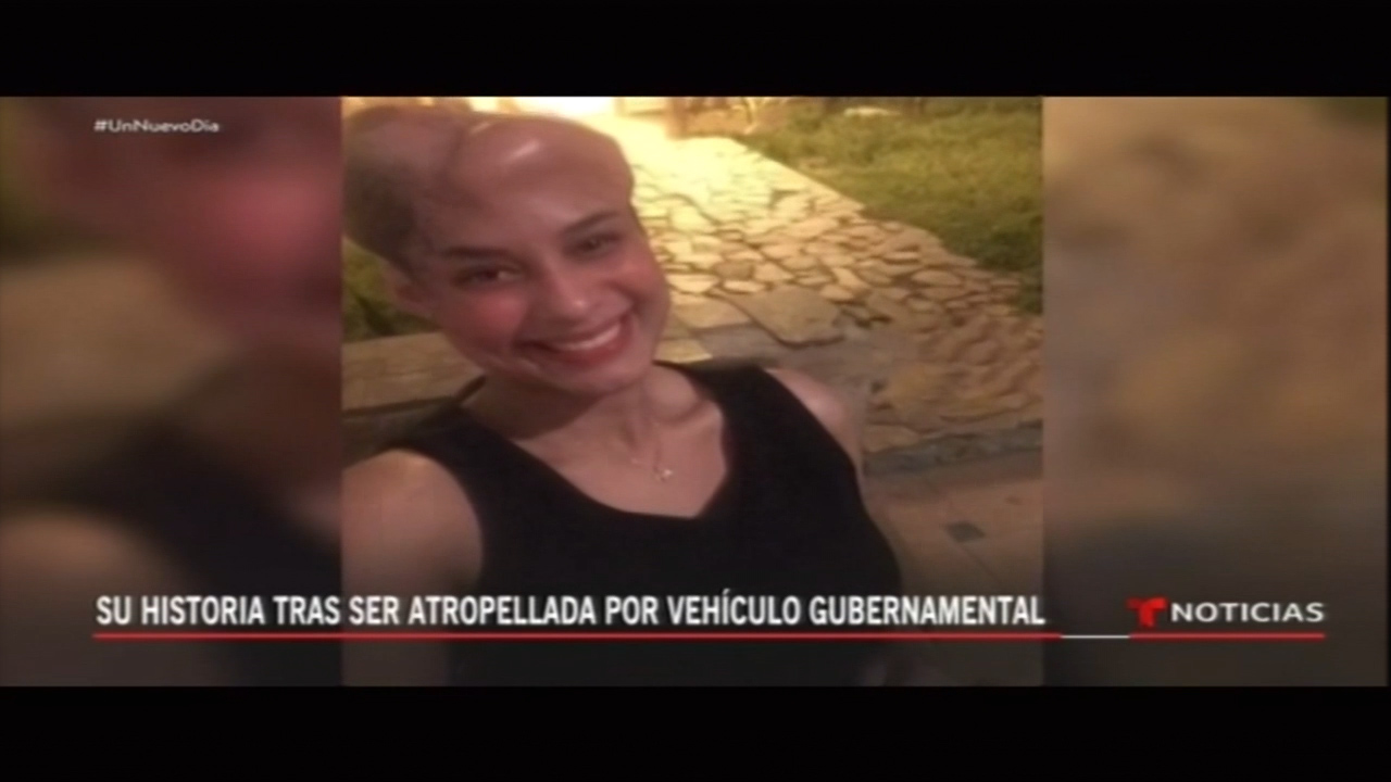 En Exclusiva: Joven Venezolana Cuenta Su Historia Tras Ser Atropellada Por Un Vehículo Gubernamental