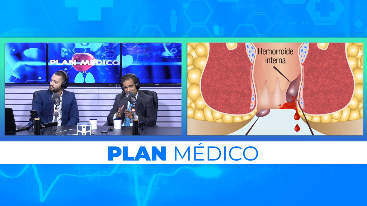 Los Principales Signos Y Síntomas De Las Hemorroides | Plan Médico