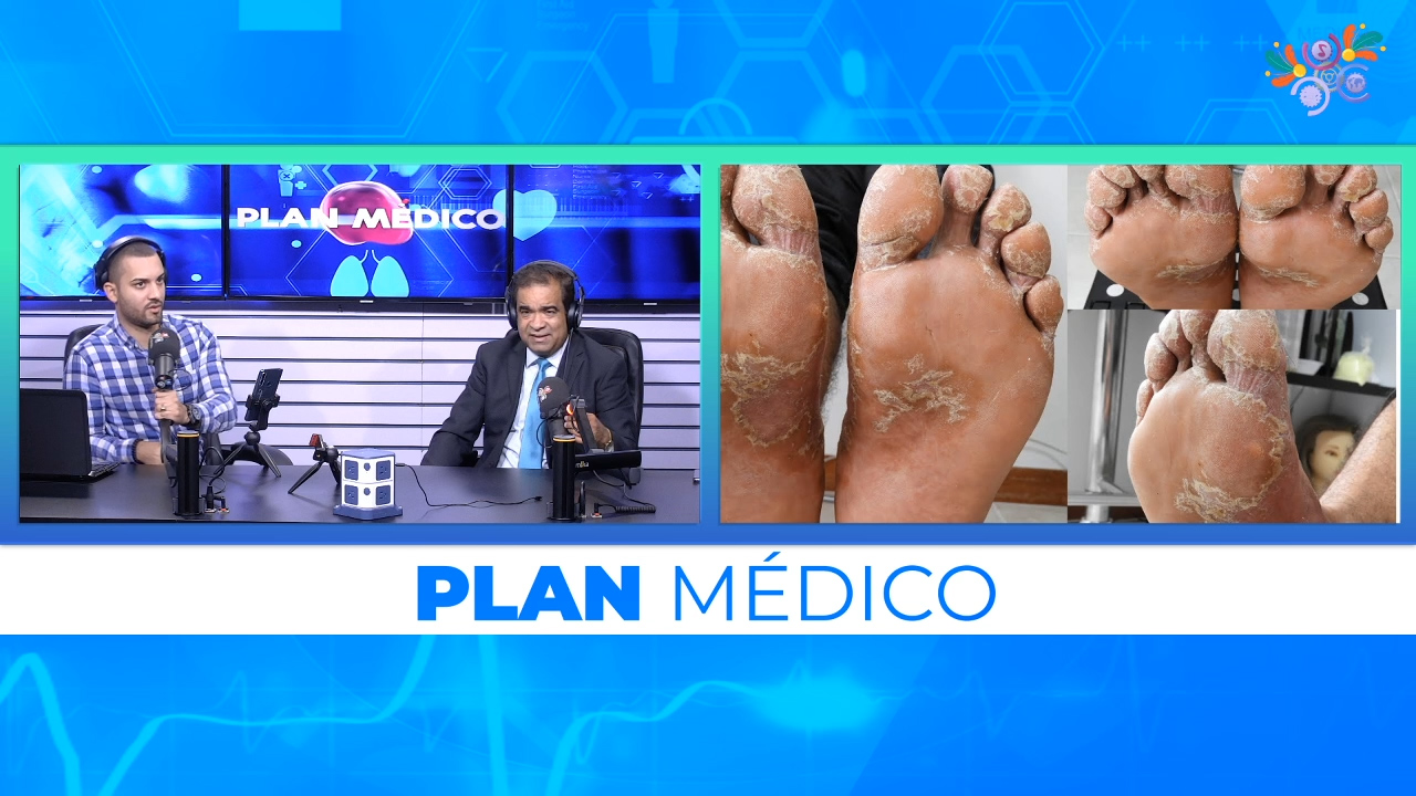 El remedio casero para curar el pie de atleta Plan Médico