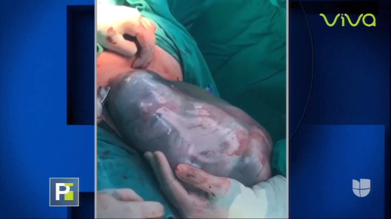 Un Milagro Mujer Con COVID-19 Da A Luz A Una Bebe Sana Y De Que Manera