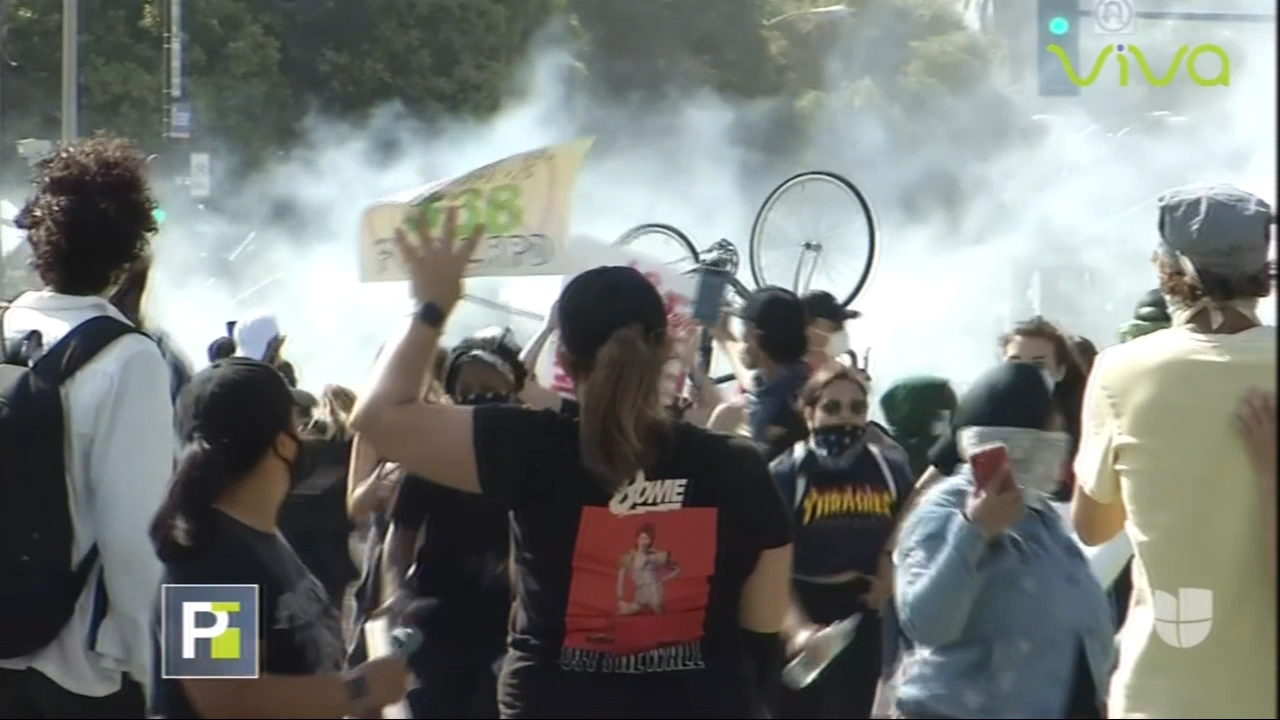 Reportera Cuenta Como Fue Alcanzada Por Una Bala De Goma En Los Angeles