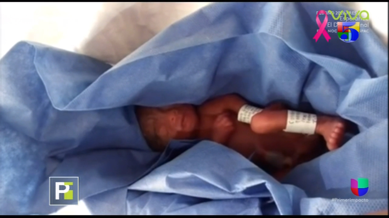 Dan Por Muerto A Un Bebe Prematuro Lo Entran Al Congelador Y Estaba Vivo