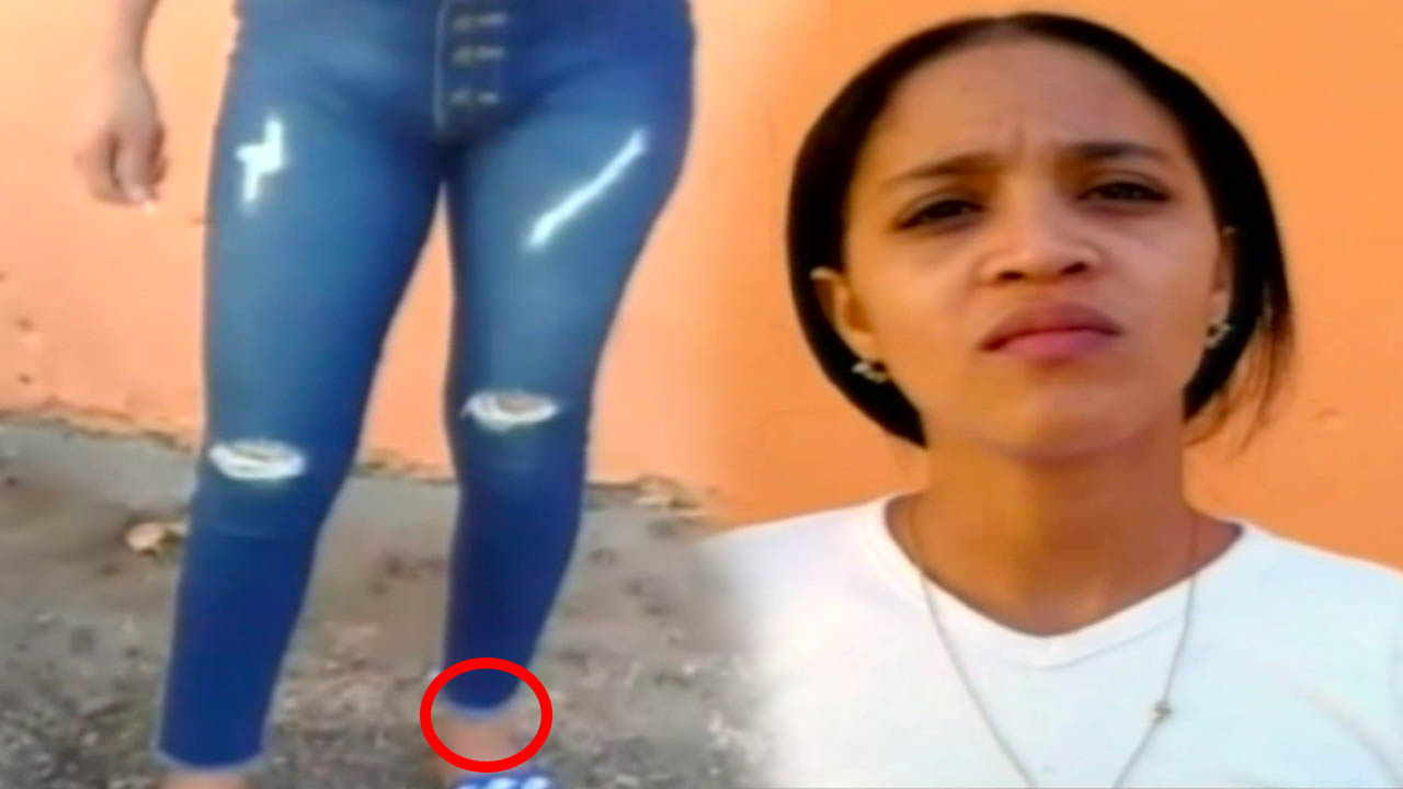 Hombres Contratan A Una Mujer Para Tener Sexo Y Luego Le Disparan En Una Pierna Sin Razón