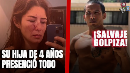Atleta Daniela López Acusa De Violencia A Su Expareja