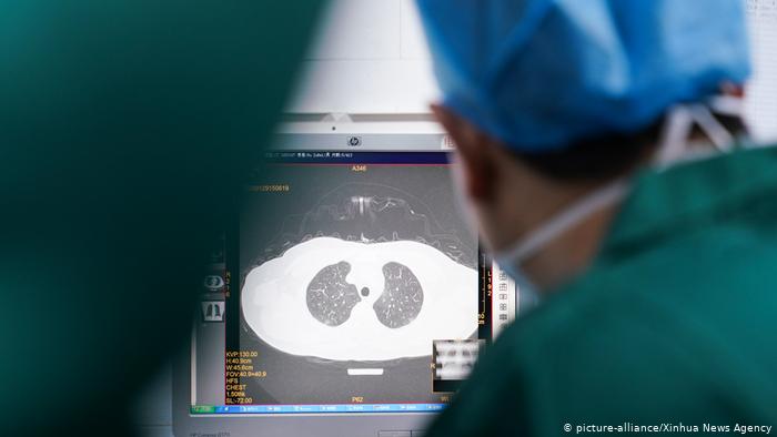 Experto Revela Las Secuelas Que Deja El COVID-19 En Sobrevivientes