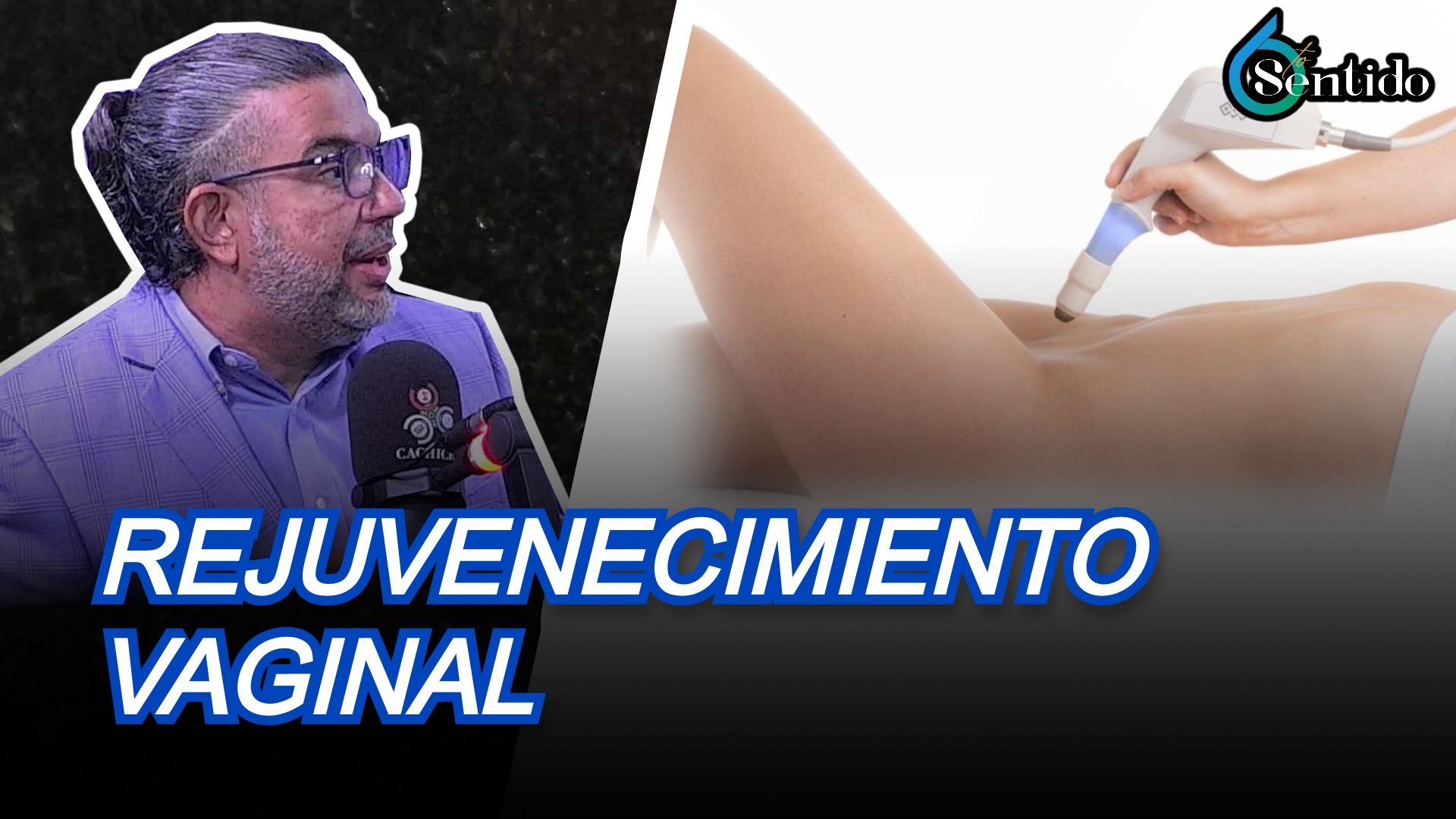 Rejuvenecimiento Vaginal: Tratamiento Con Láser | 6to Sentido