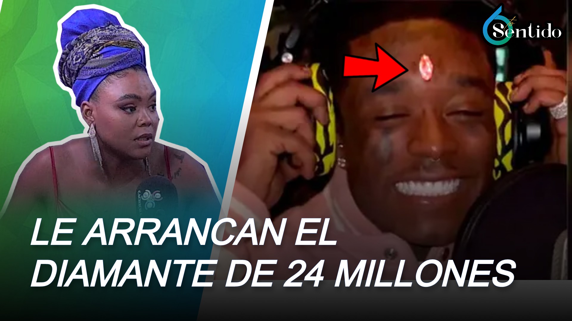 Arrancan Al Rapero Lil Uzi Vert El Diamante De 24 Millones De Dólares Que Se Incrustó En La Frente | 6to Sentido