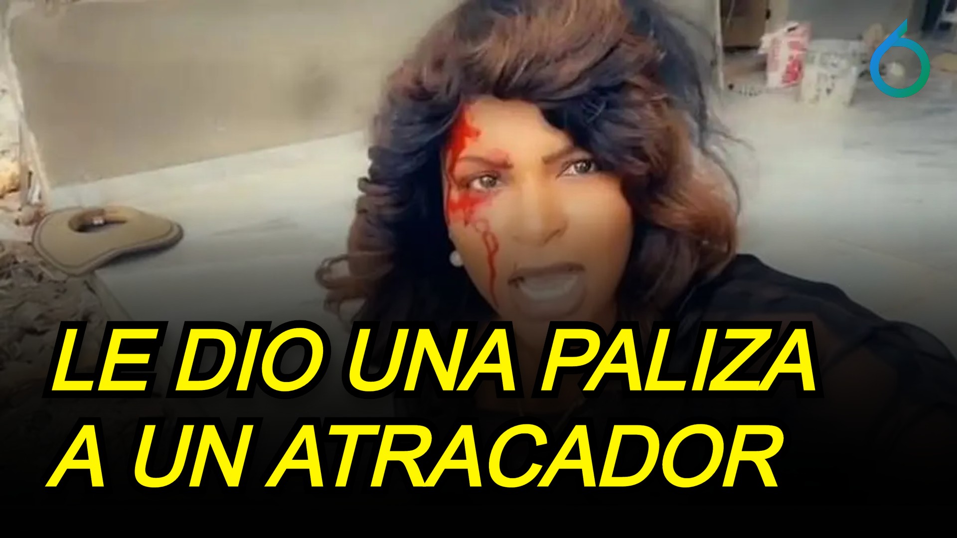 Pese A Estar Herida De Bala, Le Dio Una Paliza A Un Atracador | 6to Sentido