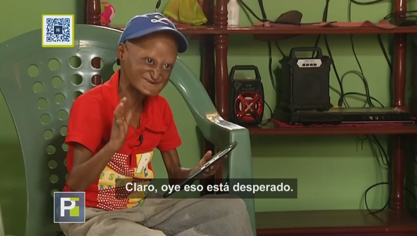 La Historia Del Hombre Que Vive Atrapado En El Cuerpo De Un Niño Que Envejece Rápido