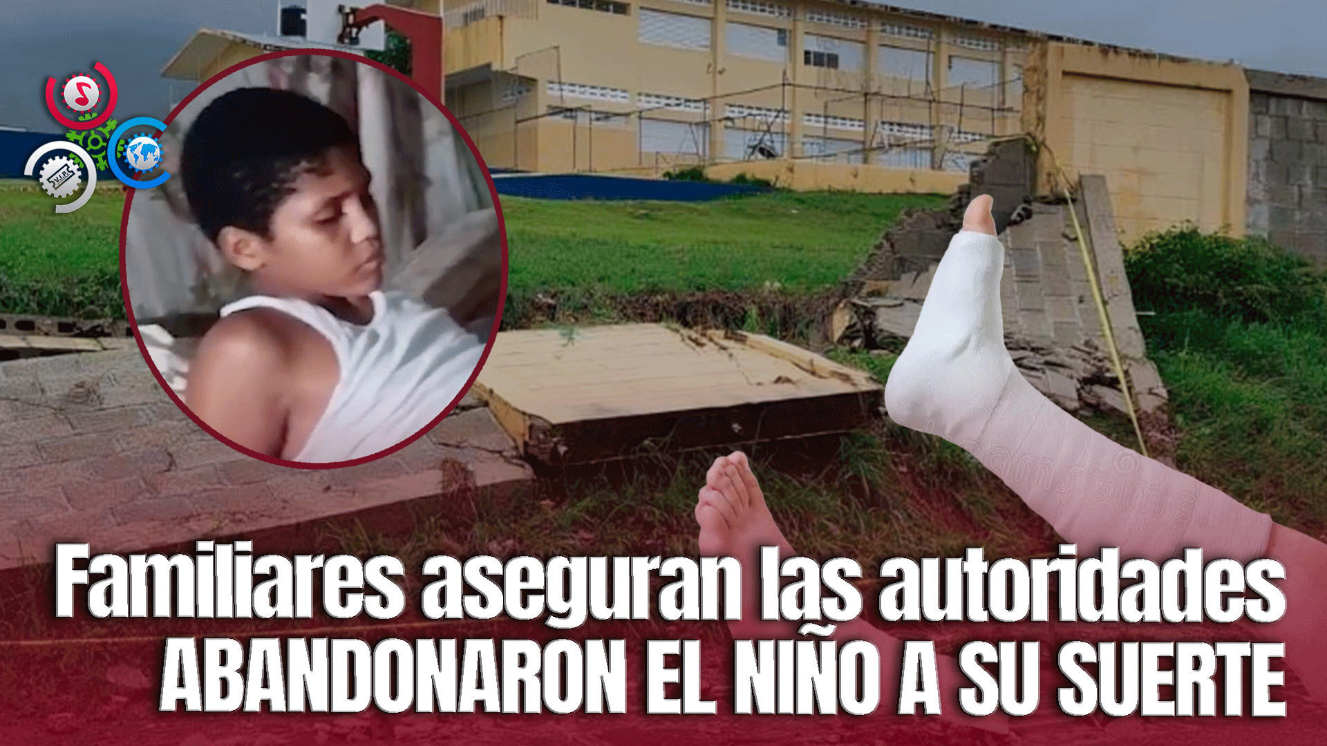 Caída De Pared En Una Escuela Deja Graves Secuelas En Estudiante De 13 Años
