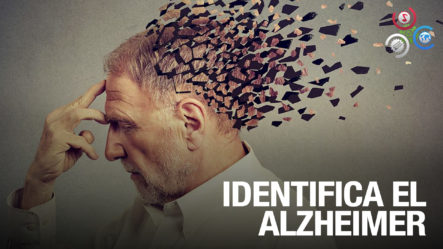Doctor Da Valiosos Tips Para Deteccion Temprana Del Alzheimer
