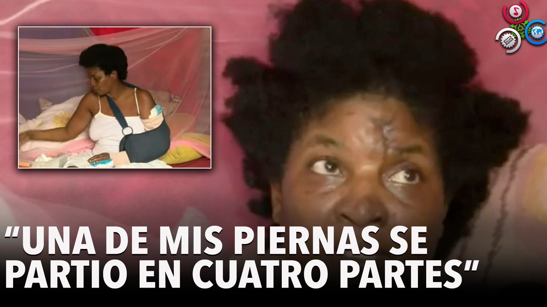 Mujer Exige Justicia Tras Ser Atropellada Por Motociclistas