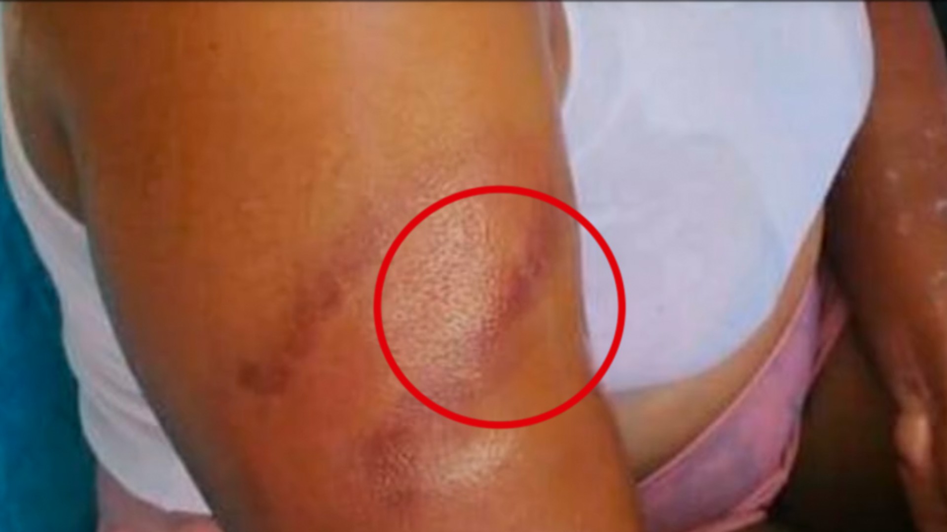 Agentes De La P.N. Maltratan A Una Mujer Y No Se Puede Defender