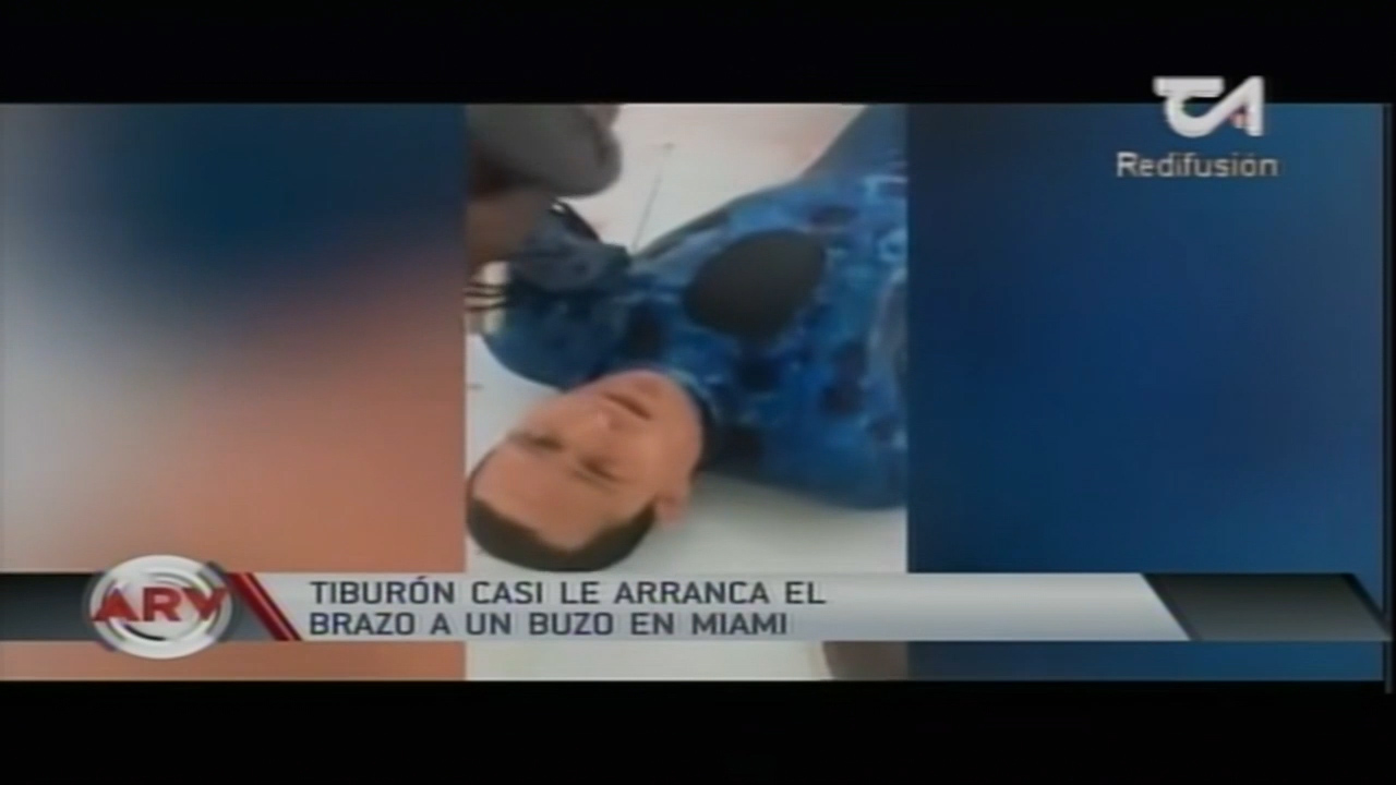 Tiburón Casi Le Arranca Un Brazo A Un Buzo En Miami
