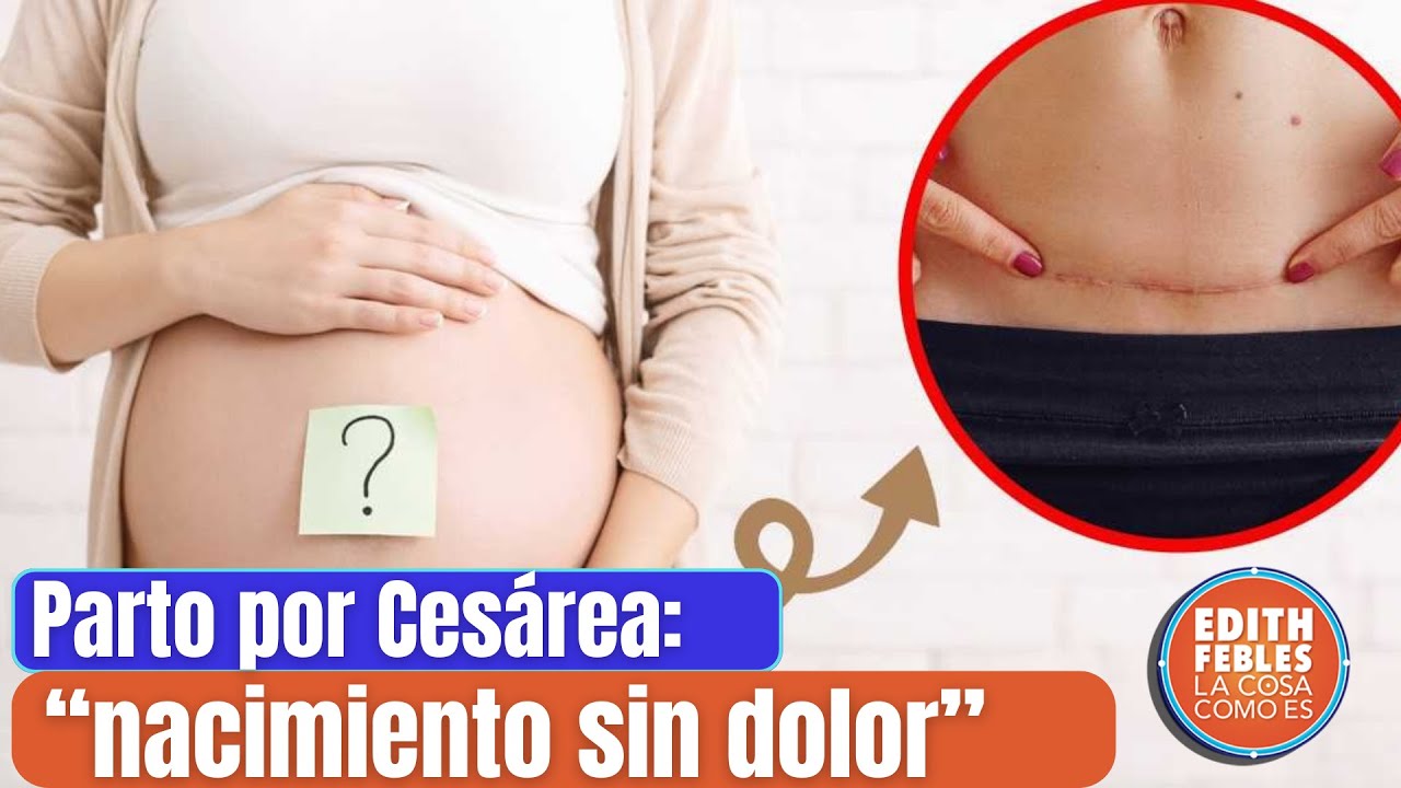 Alarmantes Los Altos Porcentajes De Partos Por Cesáreas En El País