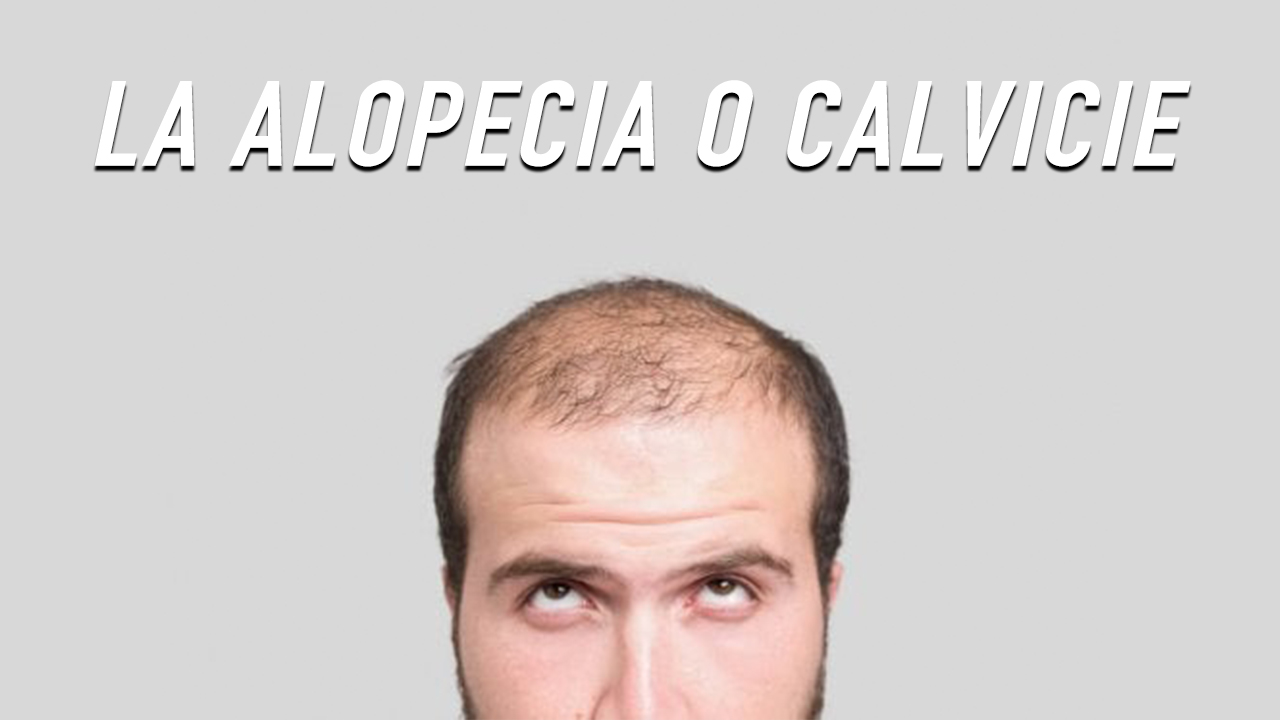 La Alopecia O Calvicie ¿qué Lo Provoca? | Plan Médico