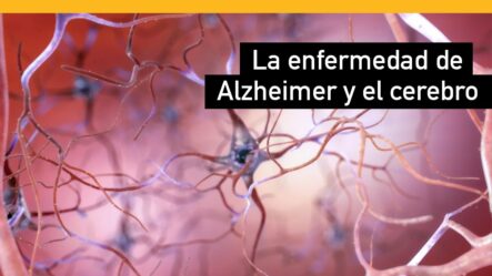 Cómo Cambia La Enfermedad De Alzheimer Al Cerebro (Trastorno Cerebral)