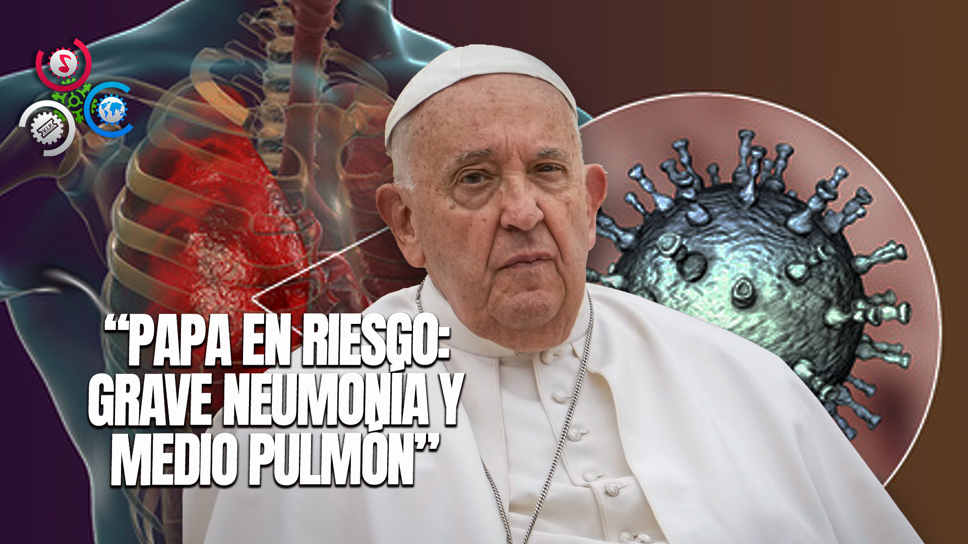 Aseguran Que Neumonía Del Papa “es Bastante Grave” Porque Le Falta Medio Pulmón