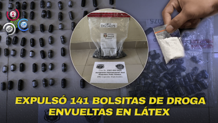 Atrapan A Francés En El AILA Con El Estómago Lleno De Cocaína Rumbo A París