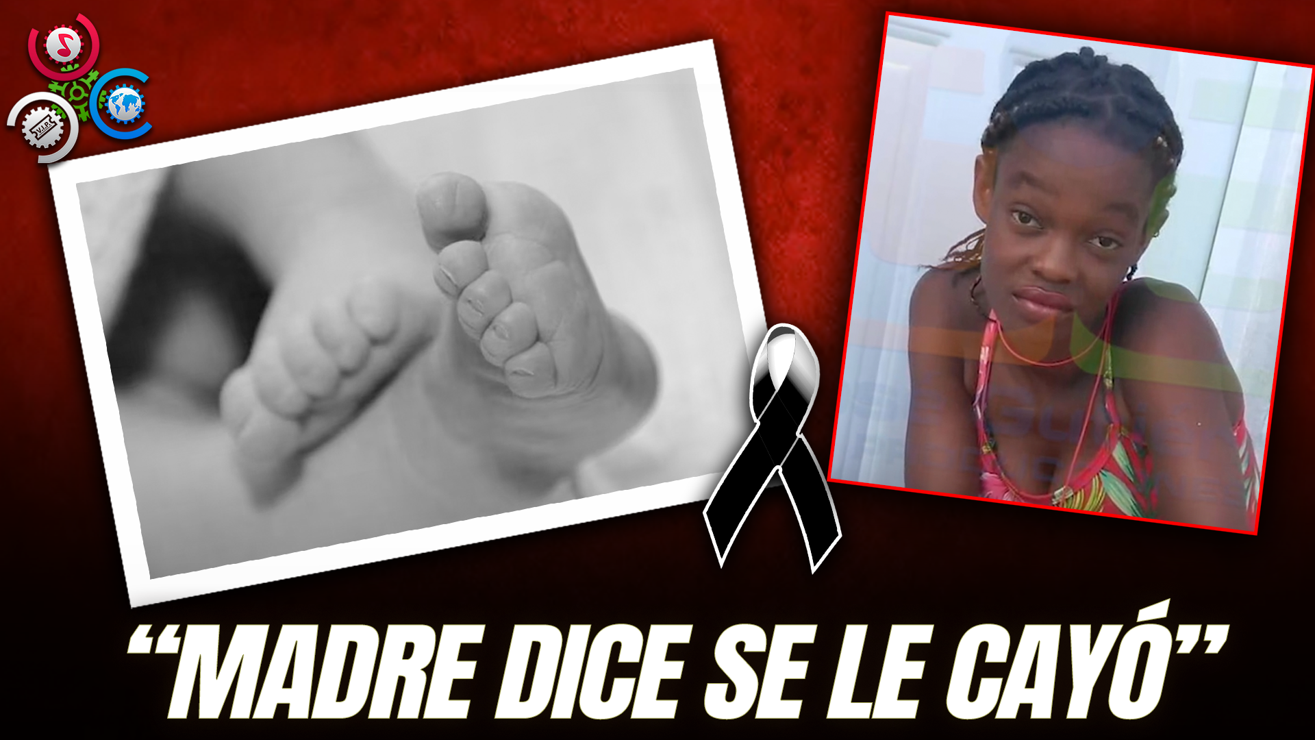 Niño De 8 Meses Muere Tras Golpearse En La Cabeza En Santiago