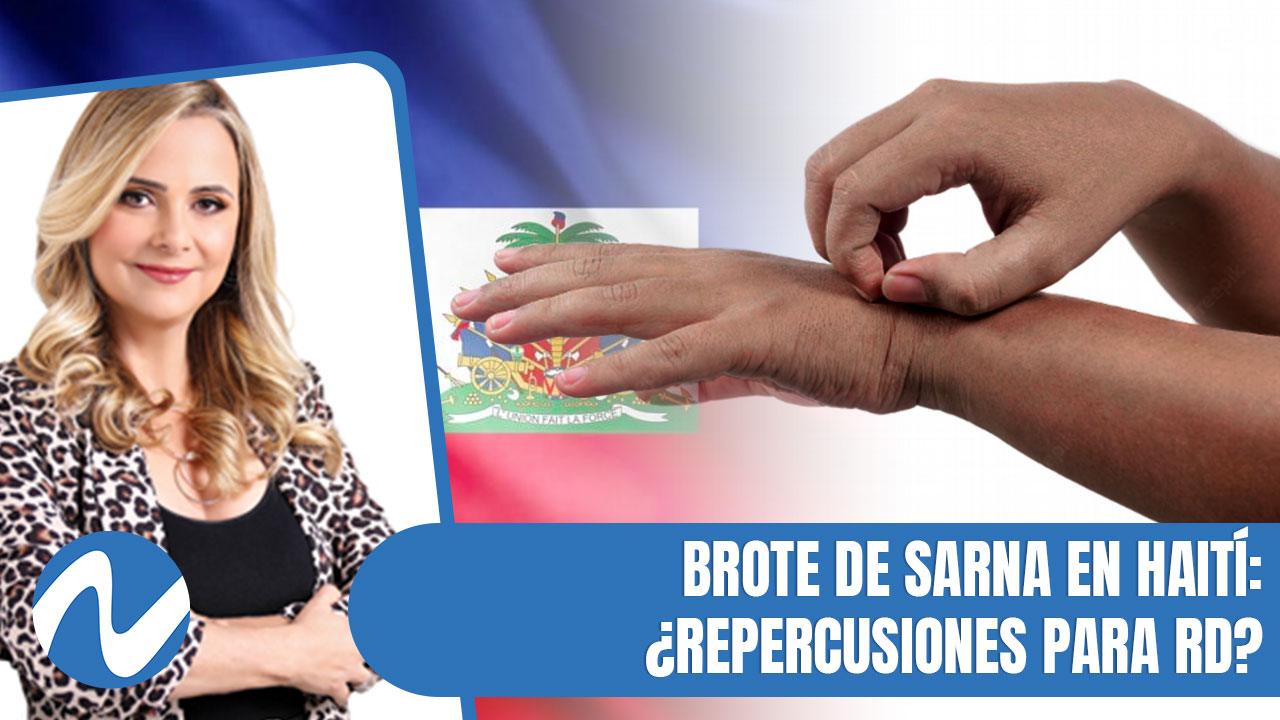 Brote De Sarna En Haití ¿Repercusiones Para RD | Nuria Piera