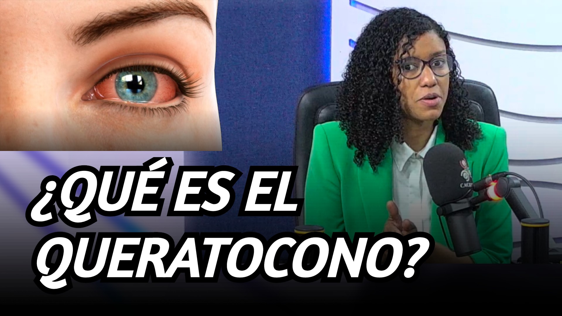 ¿Qué Es El Queratocono Y Qué Síntomas Tiene? | 6to Sentido