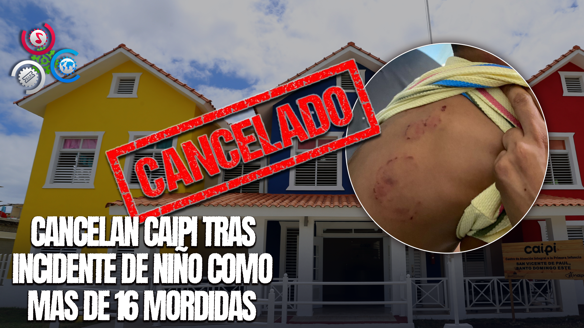 Inaipi Cancela A Personal De Un Caipi Por Agresión A Niño En Santiago