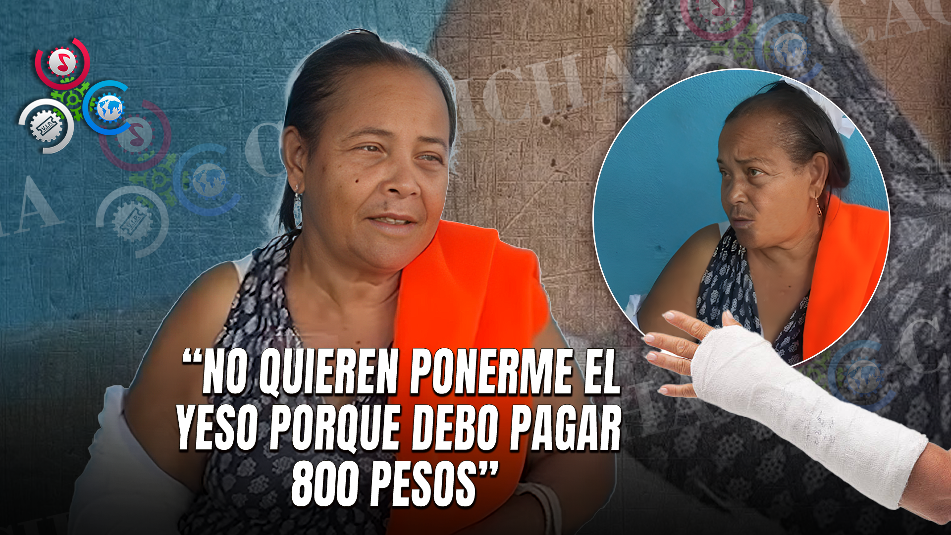 Mujer Denuncia Cobro De 800 Pesos Por Colocación De Yeso En Hospital San Vicente De Paúl