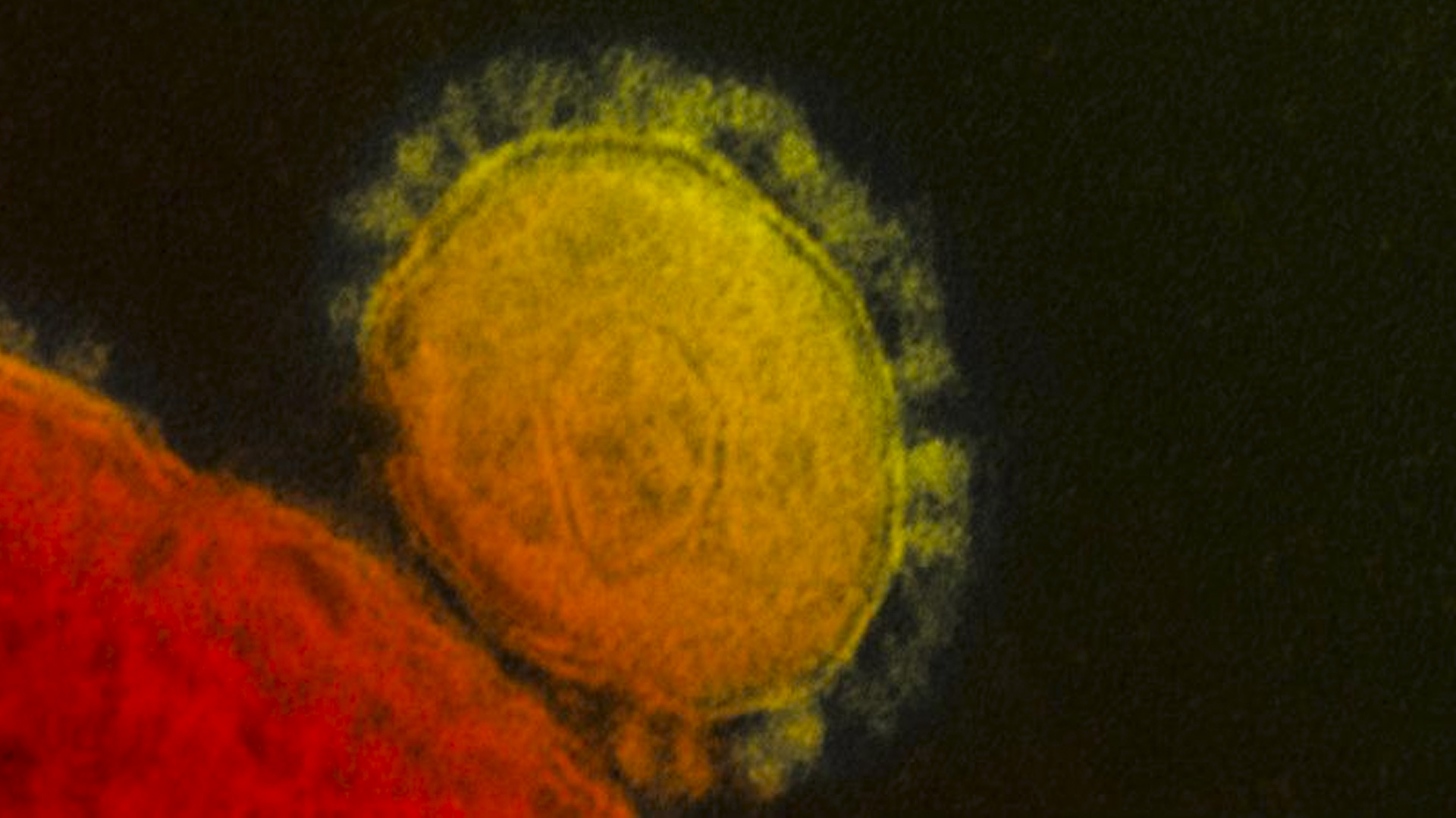 Coronavirus: Un Arma De Doble Filo Para La Población
