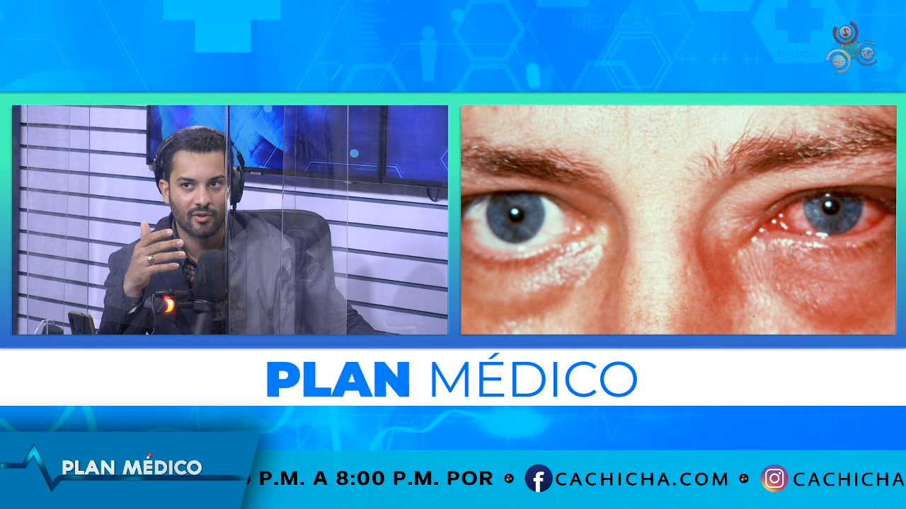 ¿Qué Es La Conjuntivitis Y Por Qué Nos Afecta? | Plan Médico
