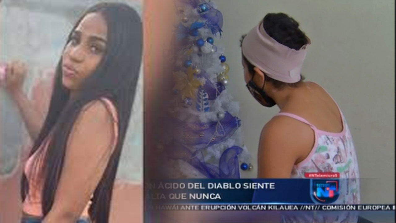 Yokairy La Joven Rociada Con ácido Del Diablo Siente El Autoestima Más Alto Que Nunca