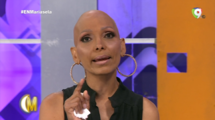 Conversando Con Yukency Sapucki La Miss Que Fue Diagnosticada Con Alopecia Areata En ENM