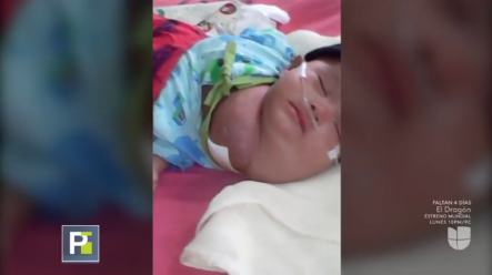 “Me Da Lástima Verlo Y Lloro”: Padre De Un Bebé De 2 Meses Con El Cuello Deformado Por Un Tumor