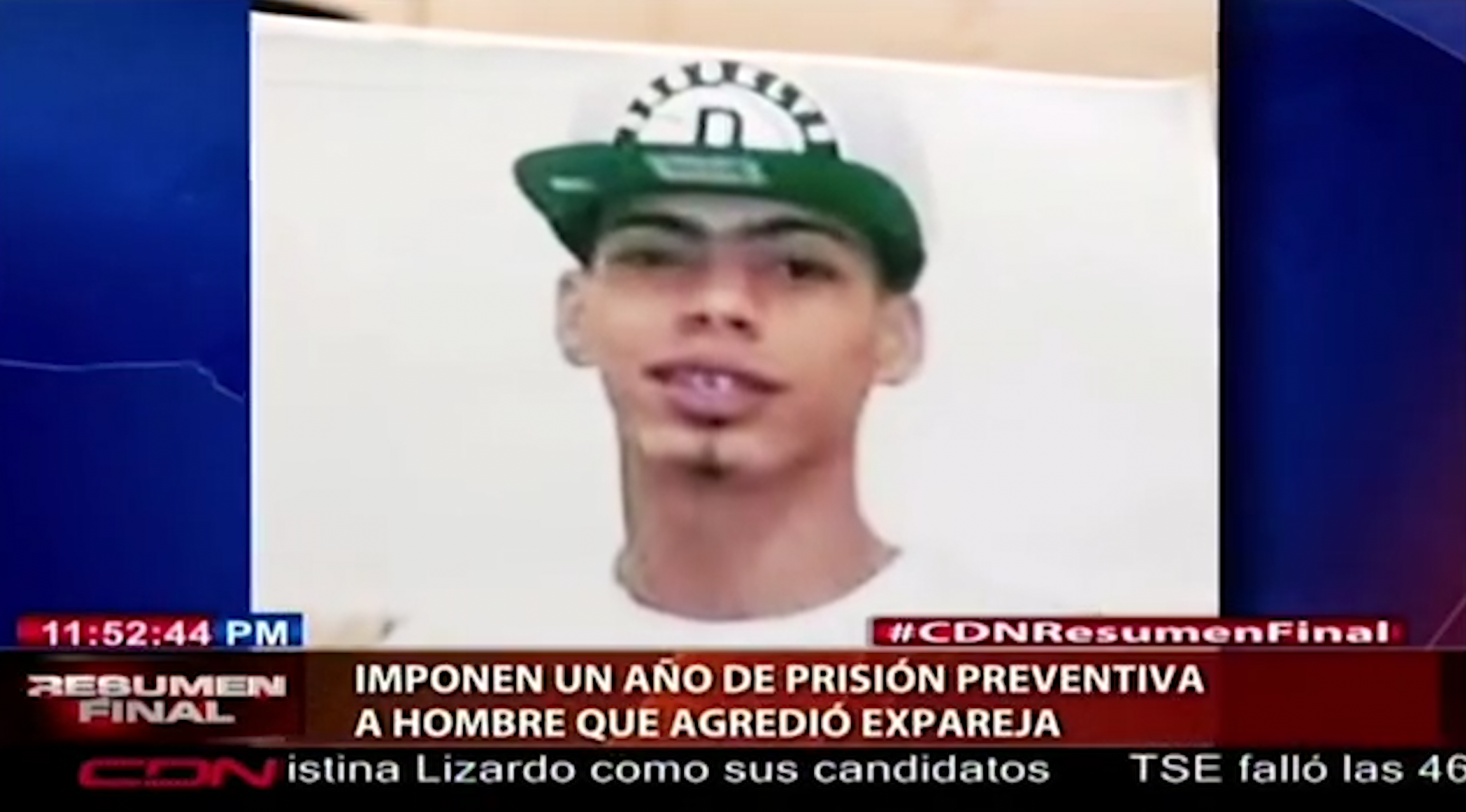 Imponen Un Año De Prisión Preventiva A Hombre Que Agredió Expareja