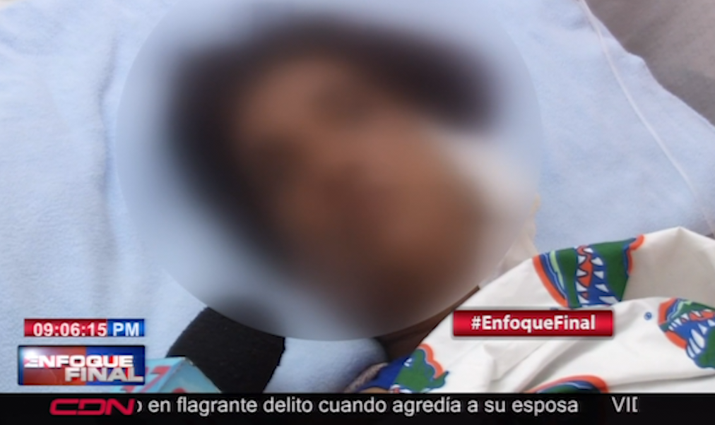 Mujer Apuñalada 16 Veces Conocía Los Antecedentes De Su Agresor Pero Temía Dejarlo