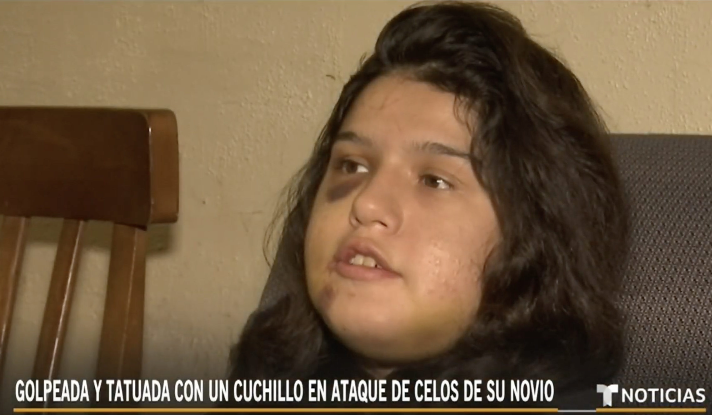 ¡Impactante! Joven Hace Público El Acto De Violencia Que Sufrió A Manos De Su Novio