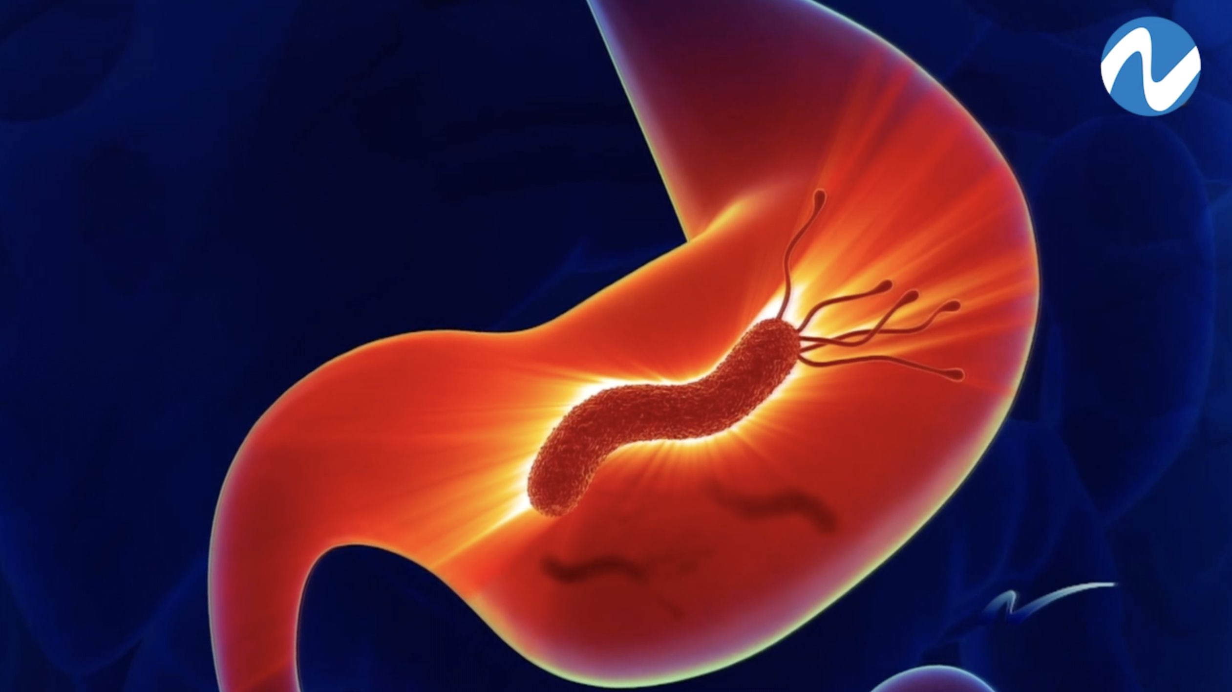 La Bacteria Que Mas Del 68% De Los Dominicanos Tiene Y Que Puede Causar Cáncer De Estómago