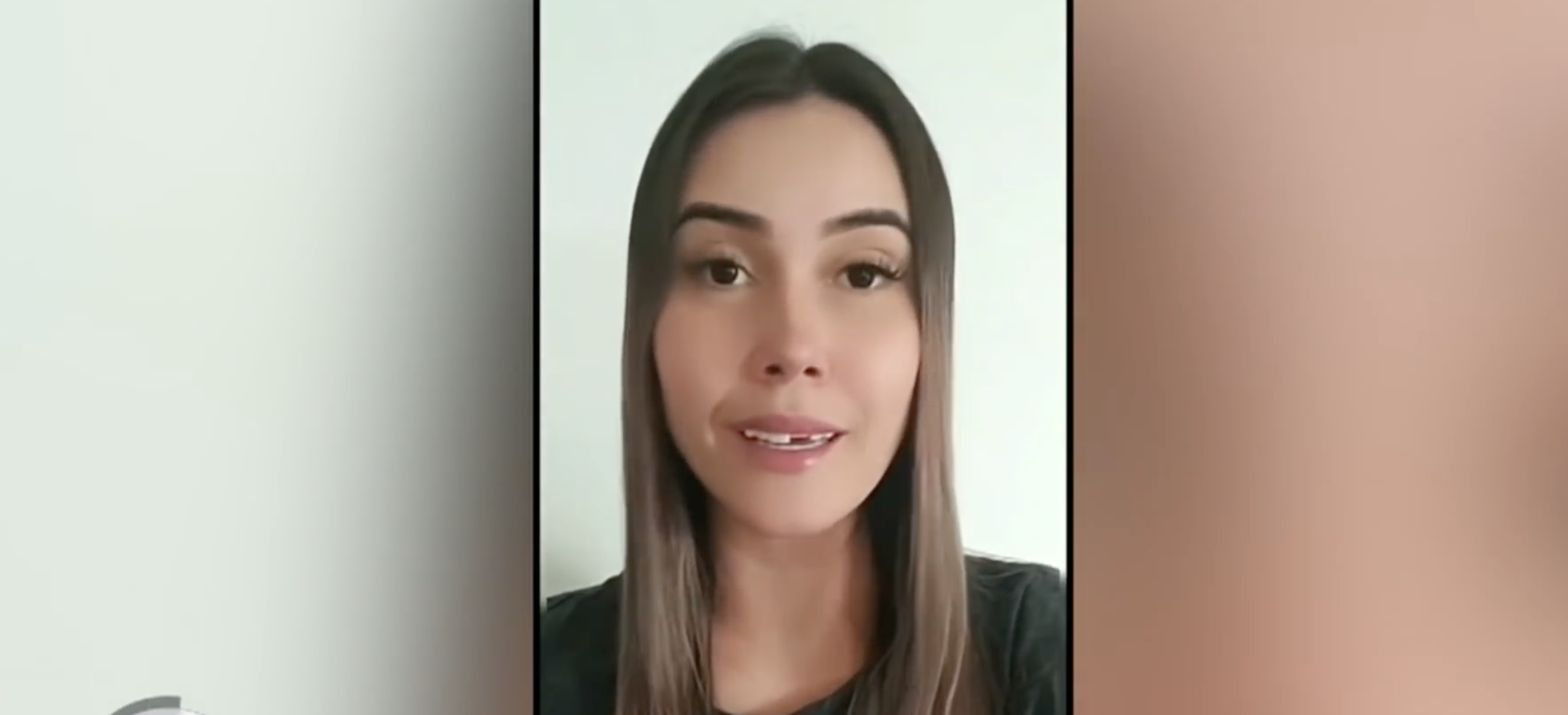Influencer Colombiana Casi Pierde Sus Dientes Al Someterse A Un Diseño De Sonrisa