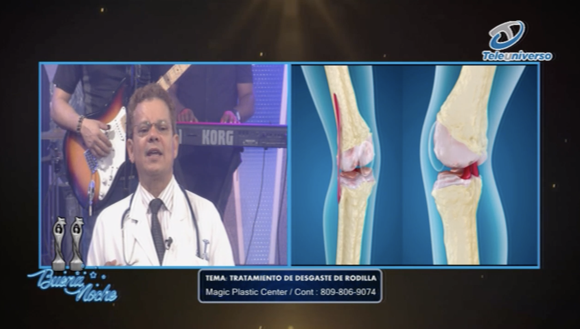 Buena Salud: Tratamiento De Desgaste De Rodilla