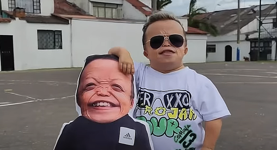 Conoce A Juan Robles  Joven Con Extraña Enfermedad Se Vuelve Un Famoso Influencer