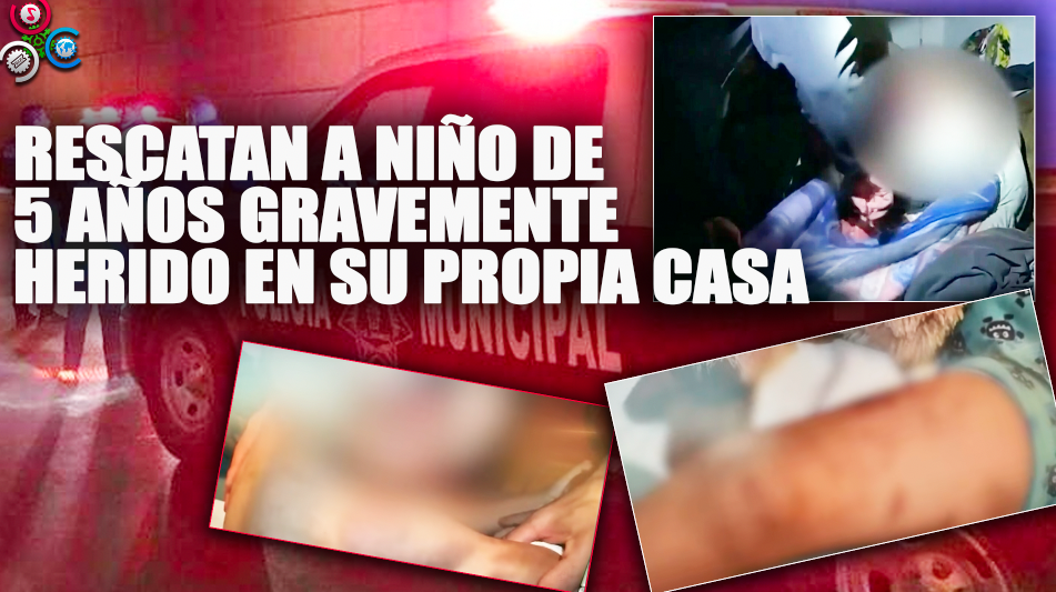 Policías Rescatan A Niño De 5 Años Gravemente Herido En Su Propia Casa
