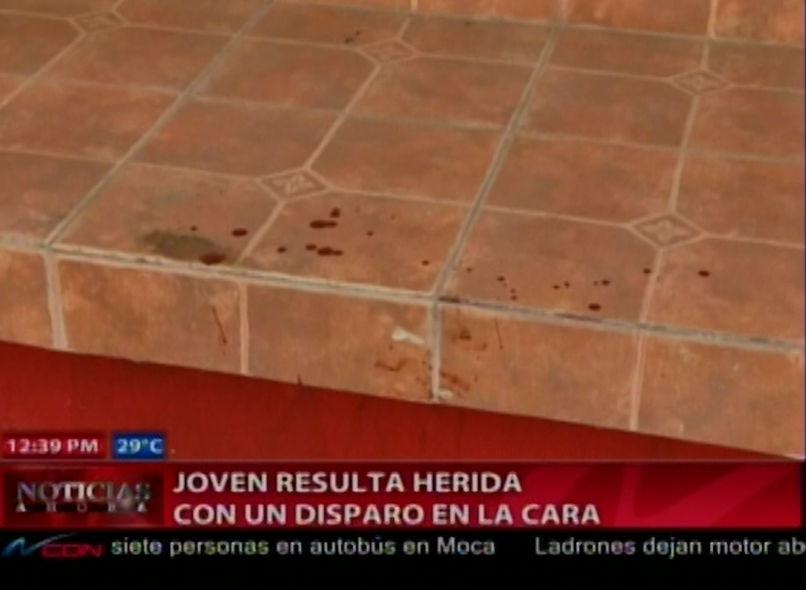 Santiago: Joven Resulta Herida Con Un Disparo En La Cara En Medio De Una Balacera