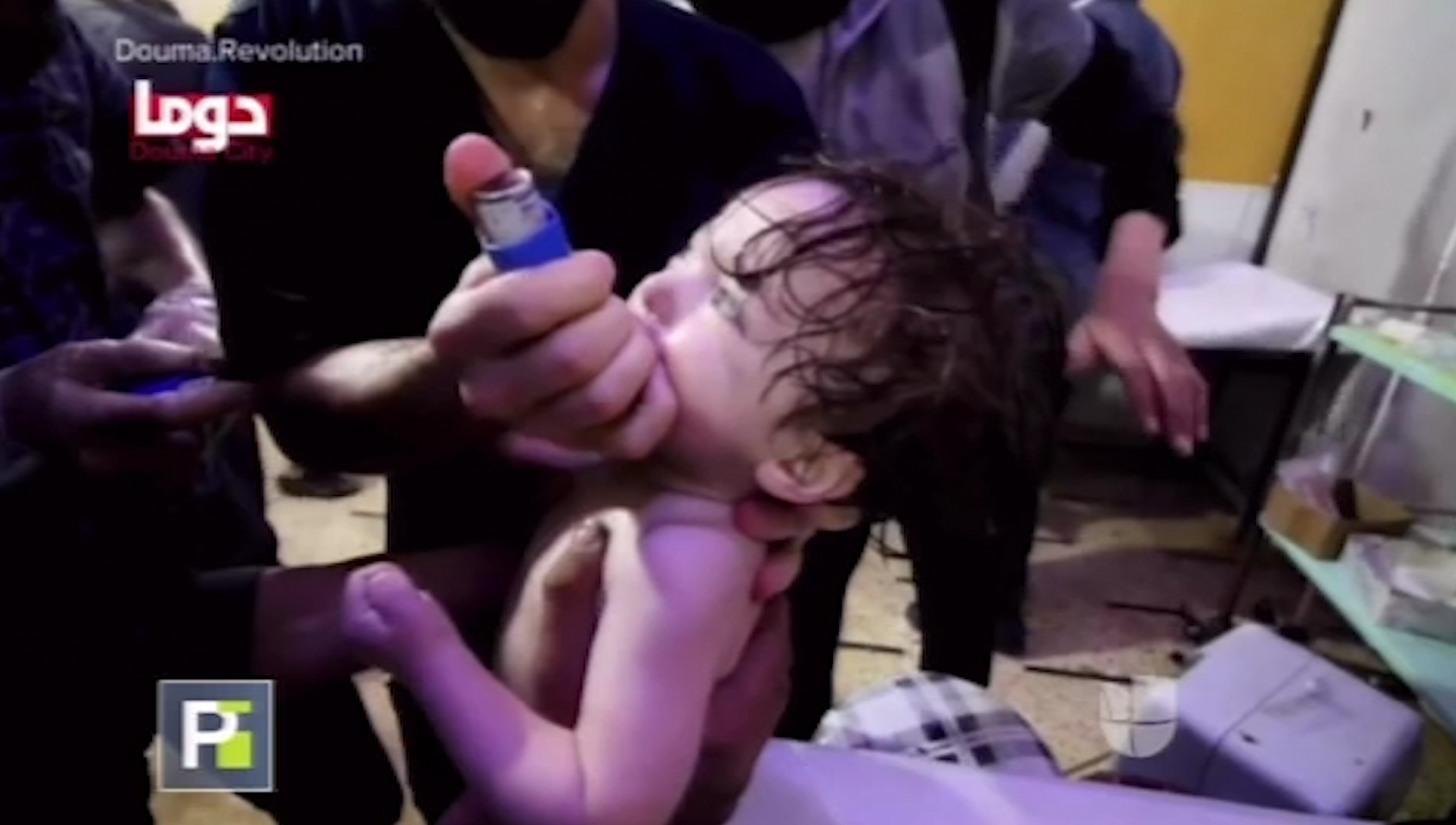 ¡INSÓLITO! Desgarradoras Imágenes De Ataque Químico En Siria