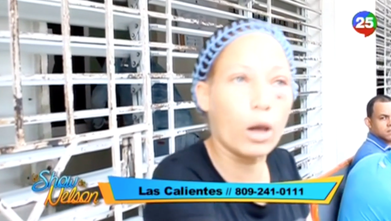 Señora Denuncia Fue Golpeada Por Un Agente De La Policía