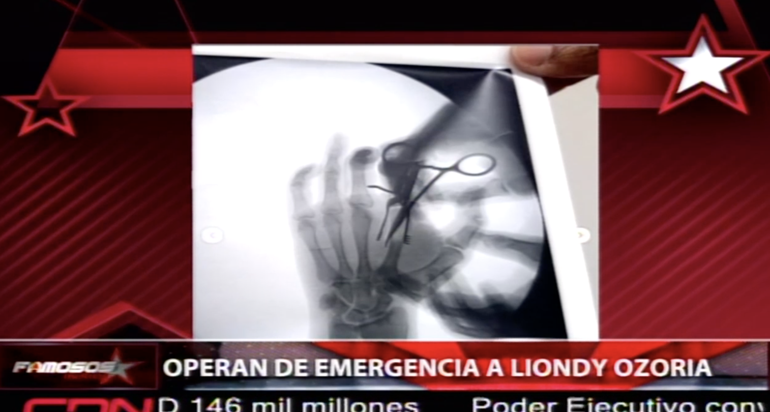 Operan De Emergencia A Liondy Ozoria