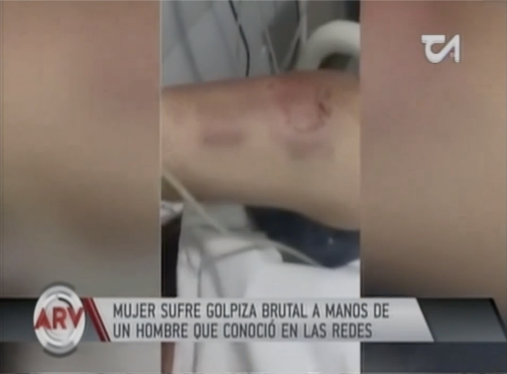 Mujer Sufre Golpiza Brutal A Manos De Un Hombre Que Conoció En Las Redes