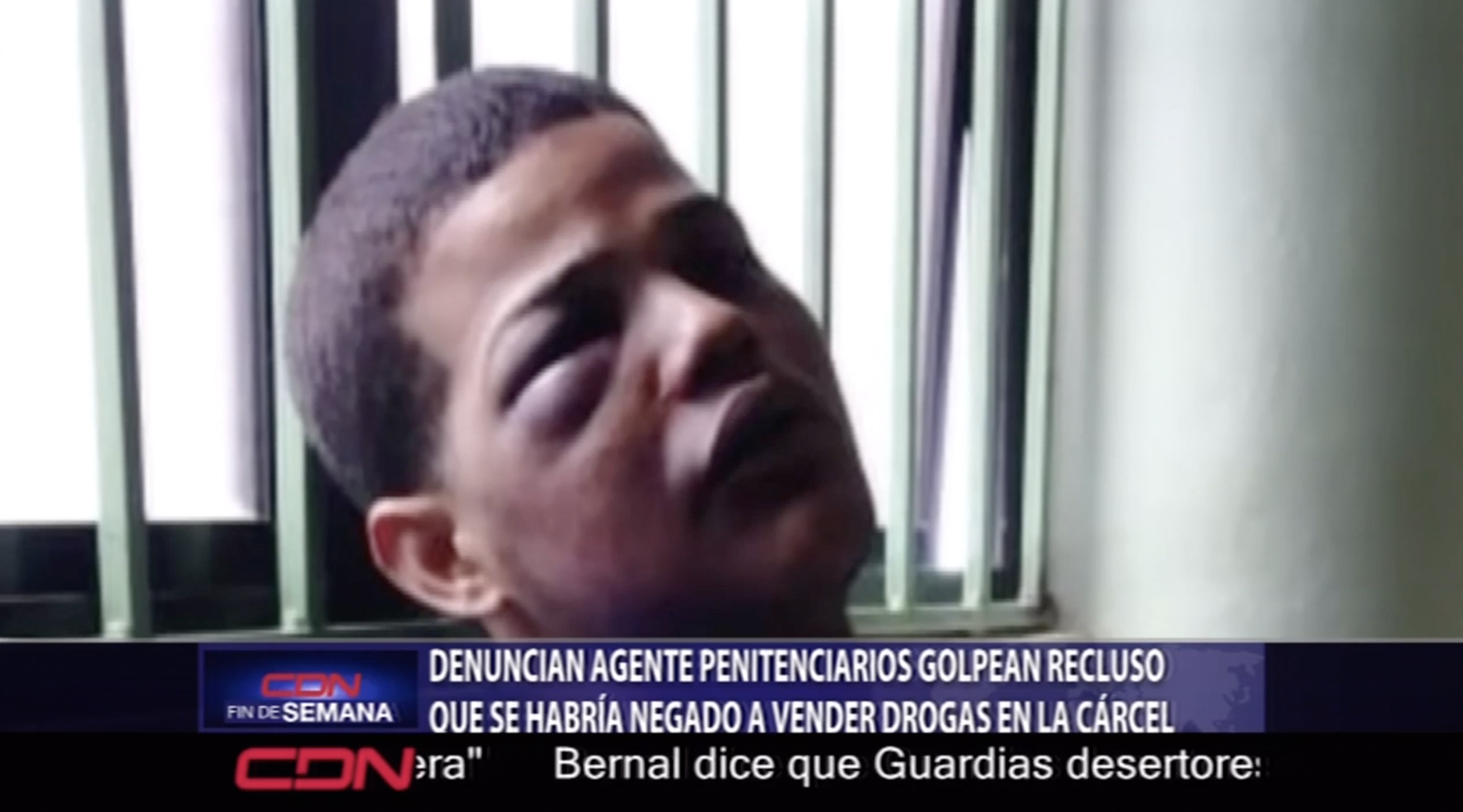 Denuncian Agente Penitenciarios Golpean Recluso Que Habría Negado A Vender Drogas En La Cárcel